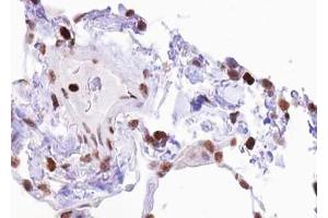 Image no. 4 for anti-ELK1, Member of ETS Oncogene Family (ELK1) (pSer383) antibody (ABIN6256307)