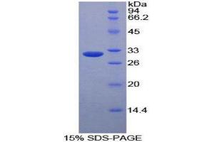 Image no. 1 for CD36 (CD36) (AA 187-428) protein (His tag,T7 tag) (ABIN1879475)