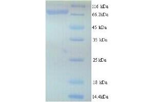 Image no. 1 for Ribonucleotide Reductase M1 (RRM1) (AA 1-792), (full length) protein (His tag) (ABIN5713802)