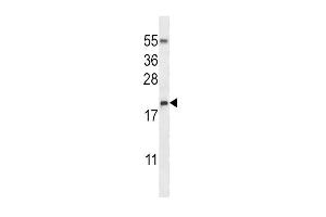 Image no. 1 for anti-Eosinophil Cationic Protein (ECP) (AA 124-151) antibody (ABIN657480)