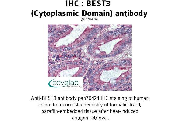 anti-Bestrophin 3 (BEST3) (Cytoplasmic Domain) antibody