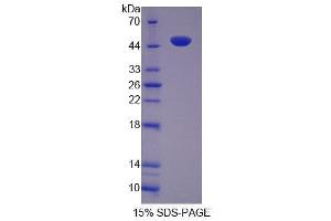 Image no. 1 for Tuftelin 1 (TUFT1) (AA 1-390) protein (His tag) (ABIN6239201)