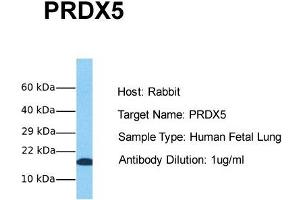 Image no. 1 for anti-Peroxiredoxin 5 (PRDX5) (Middle Region) antibody (ABIN2785911)