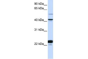 Image no. 1 for anti-EVX1 (EVX1) (N-Term) antibody (ABIN2787488)