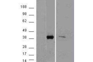 Western Blotting (WB) image for Aldo-Keto Reductase Family 1, Member B10 (Aldose Reductase) (AKR1B10) peptide (ABIN369716)