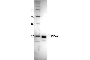 Western Blotting (WB) image for Lambda Protein Phosphatase (ABIN2451908)