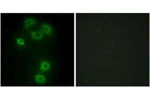 Image no. 3 for anti-BMX Non-Receptor Tyrosine Kinase (BMX) (AA 11-60) antibody (ABIN1533761)