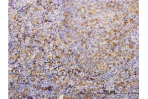 Image no. 3 for anti-Major Histocompatibility Complex, Class II, DR beta 4 (HLA-DRB4) (AA 30-266) antibody (ABIN561273)