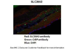 Image no. 4 for anti-Solute Carrier Family 38 Member 3 (SLC38A3) (N-Term) antibody (ABIN2775351)