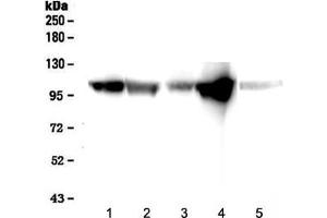 Image no. 3 for anti-alpha-Actinin Skeletal Muscle (ACTN) antibody (ABIN3029840)