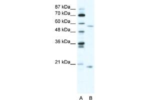 Image no. 1 for anti-Zinc Finger Protein 18 (ZNF18) (N-Term) antibody (ABIN2777979)