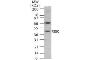 Image no. 1 for anti-serine Carboxypeptidase 1 (SCPEP1) (AA 28-43) antibody (ABIN233212)