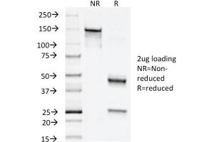 Image no. 4 for anti-Napsin A Aspartic Peptidase (NAPSA) (AA 189-299) antibody (ABIN6941161)