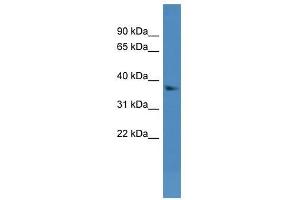 Image no. 1 for anti-Dehydrogenase/reductase (SDR Family) Member 7 (DHRS7) (N-Term) antibody (ABIN928130)