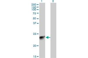 Image no. 2 for anti-Myosin, Light Chain 3 (MYL3) (AA 1-195) antibody (ABIN518152)