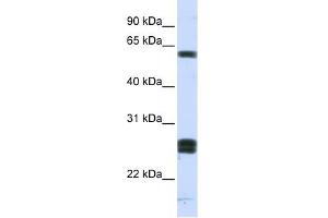 Image no. 1 for anti-Hyaluronan Binding Protein 2 (HABP2) (Middle Region) antibody (ABIN634644)