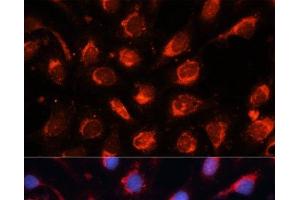Immunofluorescence analysis of U-2OS cells using RAB7A Polyclonal Antibody at dilution of 1:100.