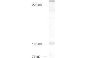 Image no. 2 for anti-Neurobeachin (NBEA) (AA 952-1320) antibody (ABIN1742399)