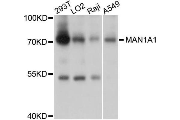 anti-Mannosidase, Alpha, Class 1A, Member 1 (MAN1A1) antibody