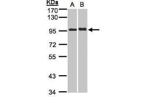 Image no. 1 for anti-Interleukin 12 Receptor, beta 2 (IL12RB2) (Internal Region) antibody (ABIN2854423)