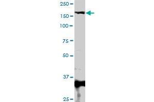 Image no. 1 for anti-Methyl-CpG Binding Domain Protein 5 (MBD5) (AA 1-229) antibody (ABIN527665)