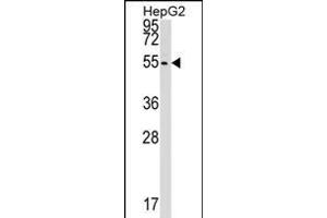 CLP1 抗体  (C-Term)