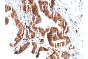 Image no. 3 for anti-Topoisomerase (DNA) I, Mitochondrial (TOP1MT) antibody (ABIN6939147)