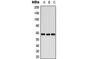 Image no. 1 for anti-Cytochrome P450, Family 8, Subfamily B, Polypeptide 1 (CYP8B1) (Center) antibody (ABIN2706001)