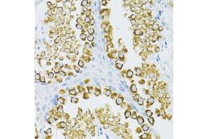 Image no. 5 for anti-Piwi-Like 1 (PIWIL1) antibody (ABIN3023050)