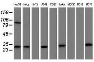 Image no. 4 for anti-Mitochondrial Translational Initiation Factor 3 (MTIF3) (AA 56-278) antibody (ABIN1491590)