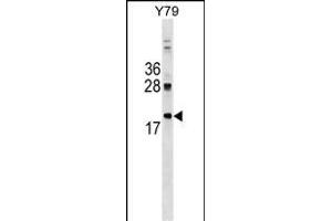 DNAJC5 Antibody (Center) (ABIN1538465 and ABIN2849241) western blot analysis in Y79 cell line lysates (35 μg/lane).