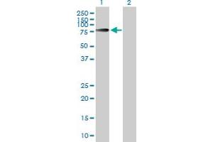 Image no. 1 for anti-Inositol Polyphosphate-5-Phosphatase, 72 KDa (INPP5E) (AA 1-644) antibody (ABIN527934)
