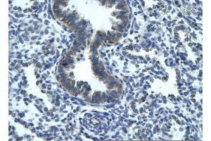 RGS19 antibody  (N-Term)