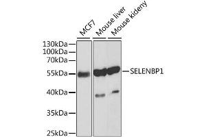 Image no. 4 for anti-Selenium Binding Protein 1 (SELENBP1) antibody (ABIN3021767)
