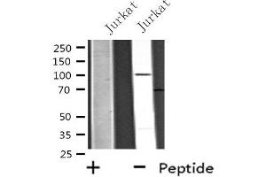 Image no. 1 for anti-Ubiquitin Specific Peptidase 11 (USP11) (Internal Region) antibody (ABIN6258345)