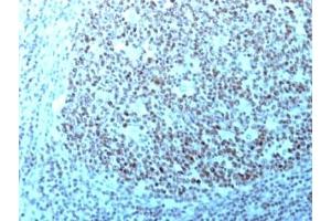 Image no. 1 for anti-Nucleolin (NCL) antibody (ABIN3025717)