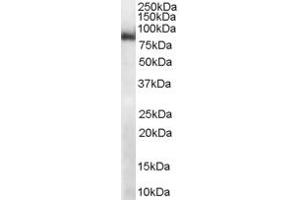 Image no. 2 for anti-Midline 2 (MID2) (C-Term) antibody (ABIN184920)