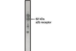 Image no. 1 for anti-Adrenergic, alpha-2B-, Receptor (ADRA2B) antibody (ABIN264463)
