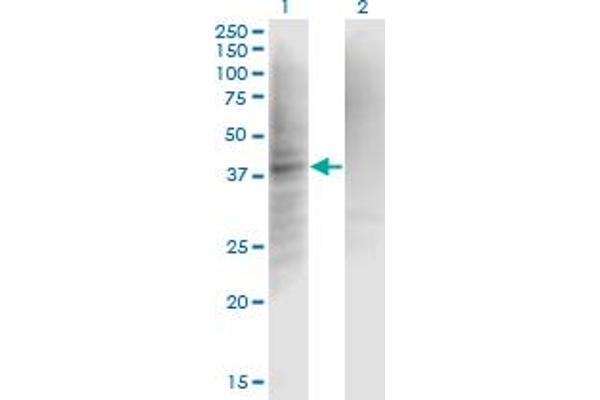Complement Factor I Antikörper  (AA 19-118)