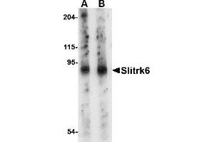 Image no. 1 for anti-SLIT and NTRK-Like Family, Member 6 (SLITRK6) (Middle Region) antibody (ABIN1031100)