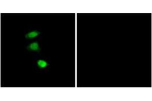 Image no. 3 for anti-Insulin Receptor Substrate 1 (IRS1) (AA 274-323), (pSer307) antibody (ABIN1531876)