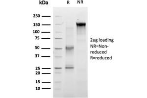 Image no. 1 for anti-Ret Proto-Oncogene (RET) (AA 702-848) antibody (ABIN6940506)