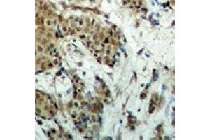 Image no. 1 for anti-MDS1 and EVI1 Complex Locus (MECOM) antibody (ABIN2966618)