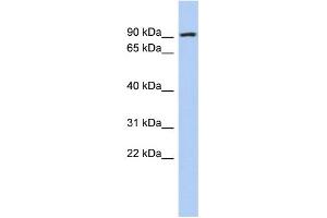 Image no. 1 for anti-Aldehyde Dehydrogenase 18 Family, Member A1 (ALDH18A1) (N-Term) antibody (ABIN2786580)