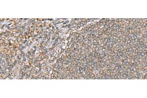 Immunohistochemistry of paraffin-embedded Human tonsil tissue using ARF5 Polyclonal Antibody at dilution of 1:55(x200)