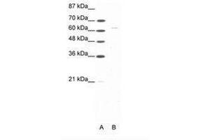Image no. 1 for anti-Forkhead Box N1 (FOXN1) (AA 51-100) antibody (ABIN202851)