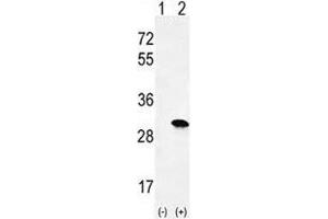 Image no. 3 for anti-HRas proto-oncogene, GTPase (HRAS) (AA 146-176) antibody (ABIN3031138)