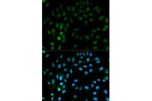 Image no. 3 for anti-Tissue Factor Pathway Inhibitor (Lipoprotein-Associated Coagulation Inhibitor) (TFPI) antibody (ABIN3022270)