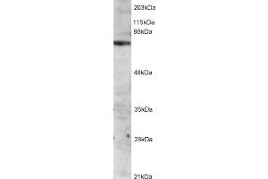 Image no. 2 for anti-IL2-Inducible T-Cell Kinase (ITK) (C-Term) antibody (ABIN184605)