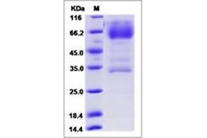 Image no. 1 for CD320 Molecule (CD320) (AA 1-210) protein (Fc Tag) (ABIN6923650)